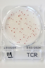 TCR